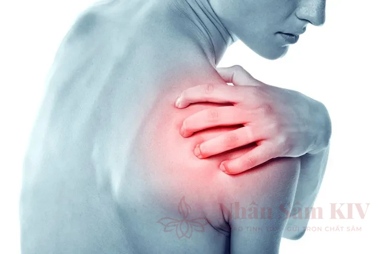 Viêm bao hoạt dịch khớp vai