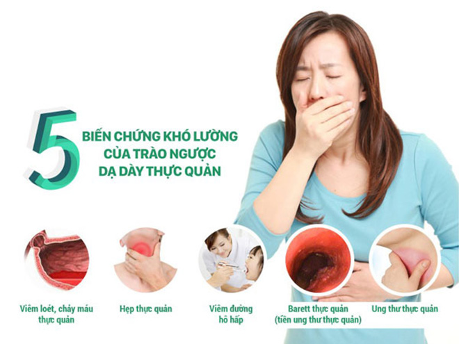 các dấu hiệu trào ngược dạ dày thực quản các dấu hiệu trào ngược dạ dày thực quản