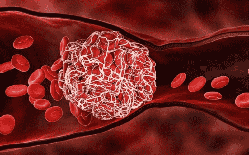 Phương pháp cải thiện lưu thông máu