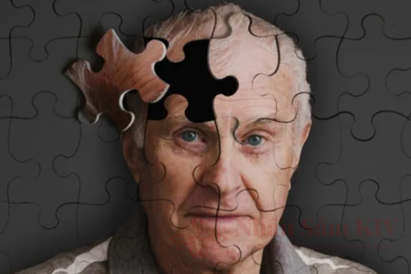 Sa s&uacute;t tr&iacute; tuệ do Bệnh Alzheimer
