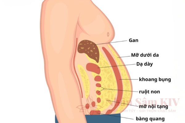 Mất c&acirc;n bằng nội tiết g&acirc;y n&ecirc;n mỡ nội tạng
