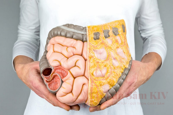 Tăng c&acirc;n v&agrave; t&iacute;ch tụ mỡ nội tạng